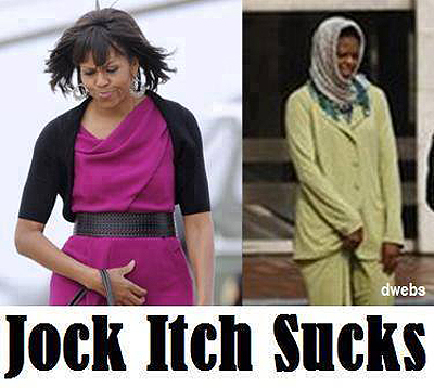 Michelle Obama has itchy balls
