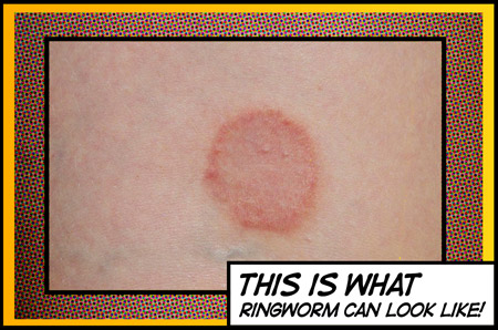 this is what ringworm can look like